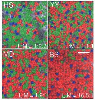 Variations in Cone Mosaics of Subjects with Normal Color Vision Adaptive optics views of the L-cone (red), M-cone (green), and S-cone (blue) mosaics of four human subjects