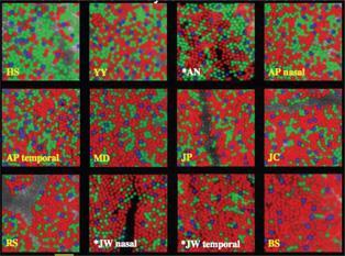 Variations in Cone Mosaics of Subjects with Normal Color Vision DR.Williams, Vis Res 51:1379 1396, 2011 DR.
