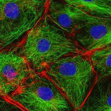 common in animal cells Cytoskeleton Network of protein filaments