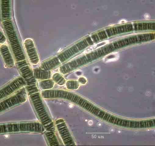 Cyanobacteria This is a group of bacteria that includes some that are single cells and some that are chains of cells.