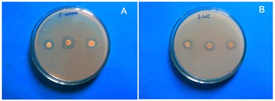 International Letters of Chemistry, Physics and Astronomy Vol. 70 39 Fig. 6. Antibacterial activity (zone of inhibition) images of A) pure MgO nanoparticles against pathogen S.