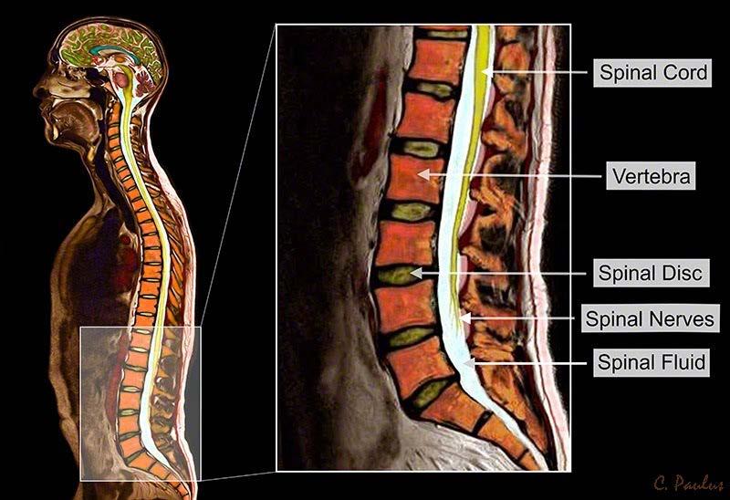 MRI images of