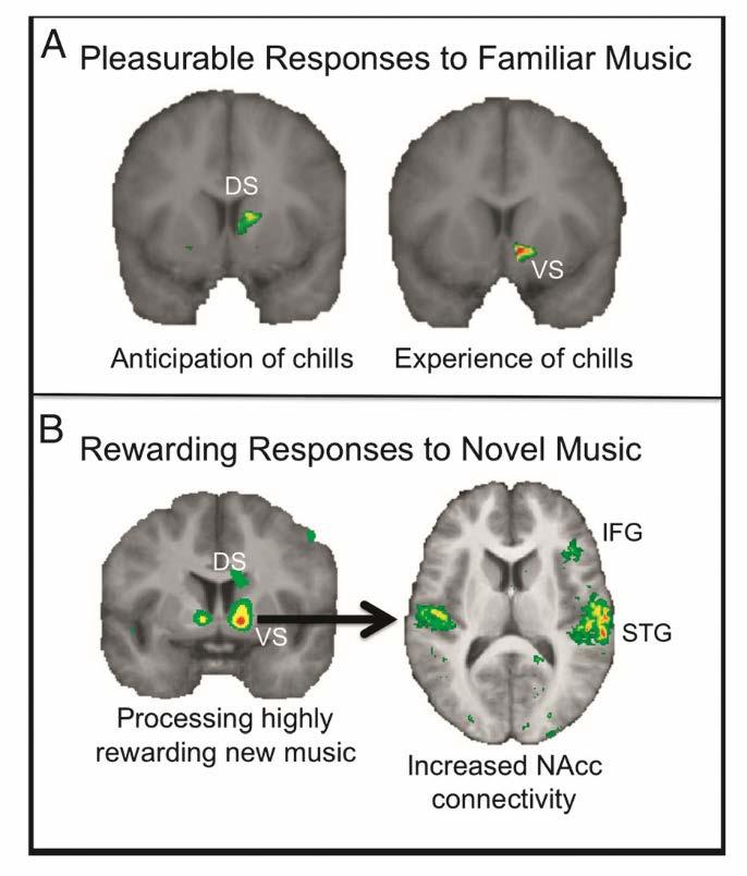 From: R.J. ZATORRE, V.N. SALIMPOOR, From Perception to Pleasure: Music and Its Neural Substrates.