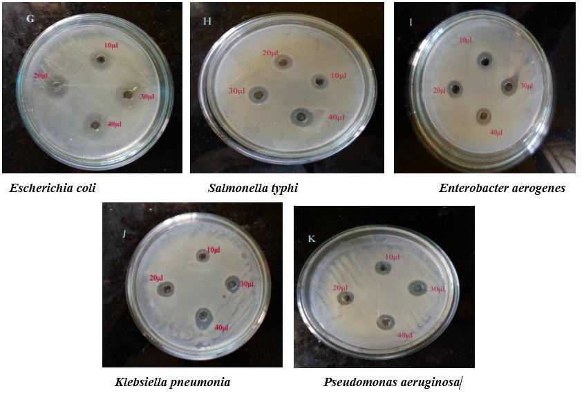 The result of this study clearly demonstrates that the synthesized AgNPs has high antibacterial activity against Gram-positive bacterial strains compared to Gram-negative bacterial strains.