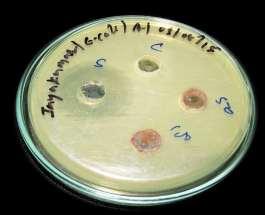 Gold nanoparticles against E.coli Fig-4.