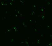 coli TCN Colony counts Fluorescence microscopy atypical green signals B 1,0E+7 1,0E+6 C. freundii (before chlorination) C.