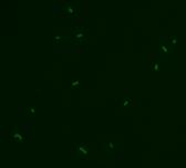 coli TCN Colony counts Fluorescence microscopy atypical green signals Figure 3.2: Quantification of E. coli (A) and C.