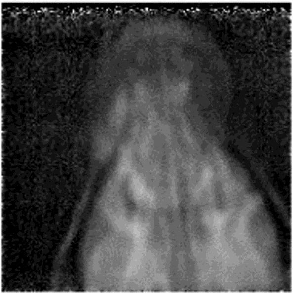 Figure 6. A proton radiograph of a canine's head obtained with the PSI system, published in 2004.