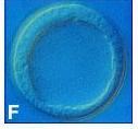 Blastula 5 th blastocoel proteinaceous fluid