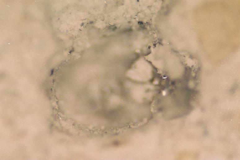 in the sample. There was large variation in size of air voids.most of air voids were hollow in nature. In few instances the voids were filled with micro globular grains.