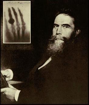 History In 1896 Roentgen discovered X-rays X-rays were first discovered accidentally by Wilhelm Conrad Röntgen.