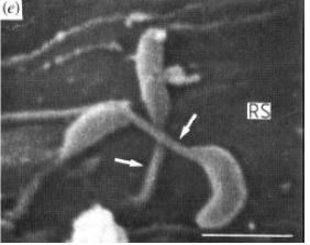 Bacterial Attachment RS = Root Surface