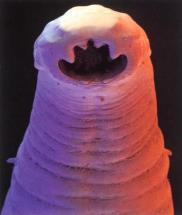 (flatworms) Acoelomate