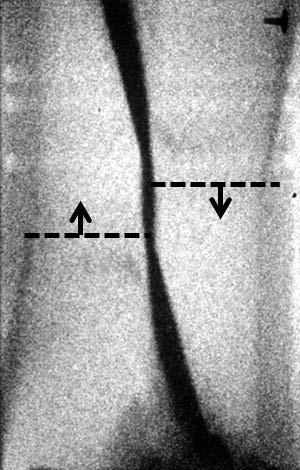 The experiment is diagnosed with radiography in geometry similar to
