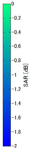 Comparison of penetration depth 40GHz 95GHz SAR [db] SAR [db] 95GHz 40GHz 75GHz cornea Aqueous