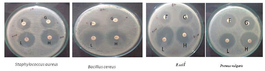 Scale bar= 100nm Fig 7: Synergistic antimicrobial activity of silver Nanoparticles and antibiotics on agar plates.