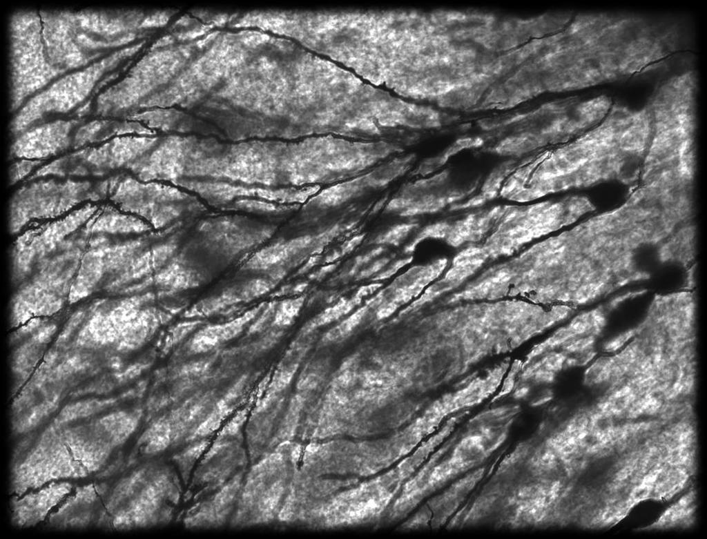 Golgi-stained Neurons in Human Hippocampal