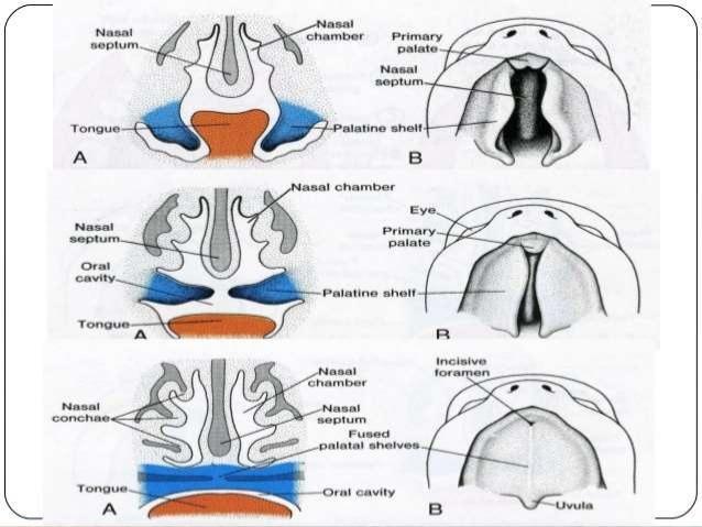 Facial Development Palate and nasal
