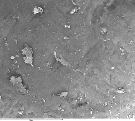 Results The SEM micrograph (20 kv) of (a)