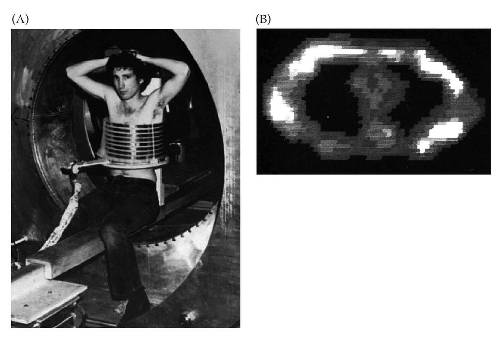 1.14 The first MR image of the human body. Raymond Damadian, 1977 First cross-sectional image of the human body.