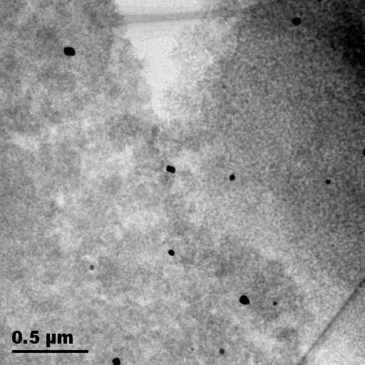 50 nm Figure 12: BF-TEM image of Au particles (black patches) on a TiO 2 support. Figure 13: