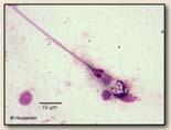 Cnidocytes () Nematocyst Barbs
