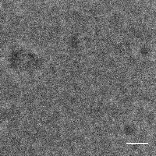 Supplementary Figure 4: EFSEM image (E C = 8eV) of P3HT:PCBM blend prior to plasma cleaning. We observe that whilst some larger structures are visible in this image, the fine detail obtained in Fig.