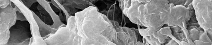 nanocomposite particles