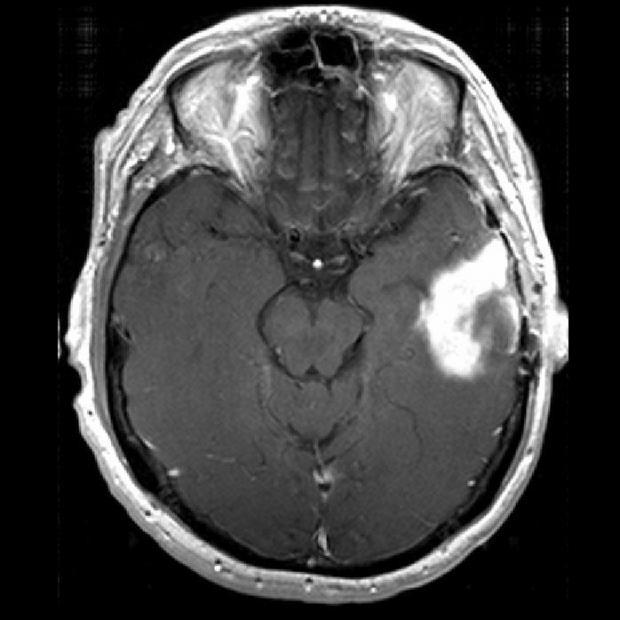 com/files/2014/03/mri-scan-normal-brain-sagital-view.