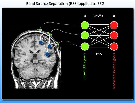 A Similar Problem: EEG