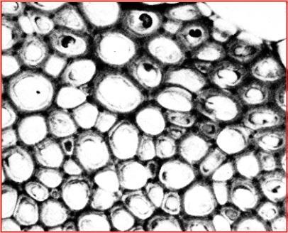 F) Sclerenchyma These are non-stretchable, waterproof, packing and strengthening cells. They are initially similar in form to parenchyma. There are two types, fibres and sclerids.