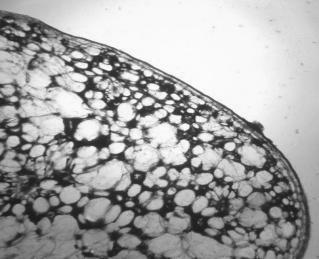 Fig. 7- mesophyll cells Fig. 8 - cuticle Fig.