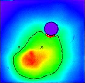Hot electron beam divergence PW laser axis 70deg (FWHM) 30 deg (FWHM) Planar Solid target