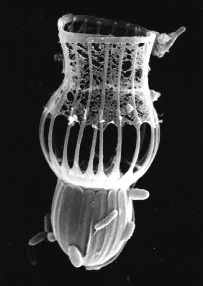 Choanoflagellates SEM of the basket-like