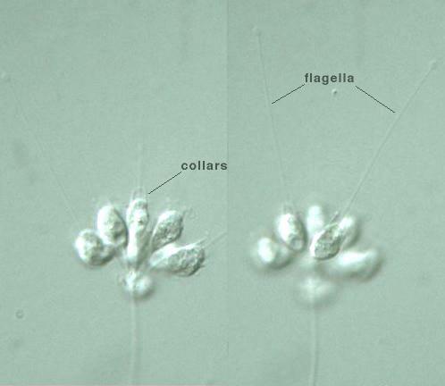 Choanoflagellates Codosiga