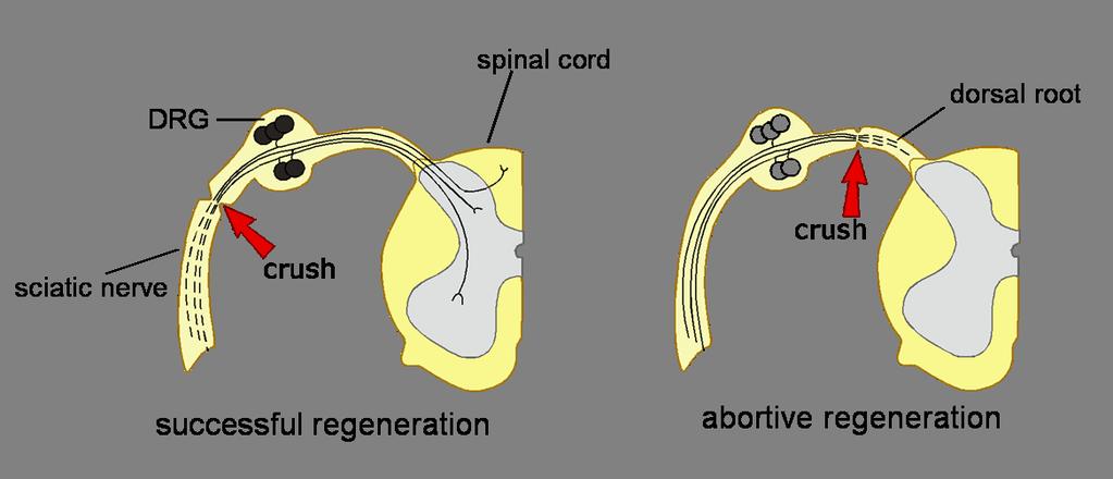 The Dorsal Root Ganglion Models of Neuronal Regeneration