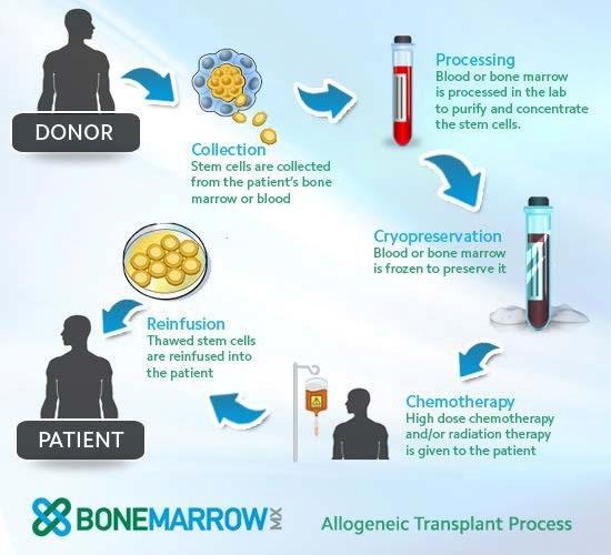 Bone Marrow Transplant https://cancer.uams.