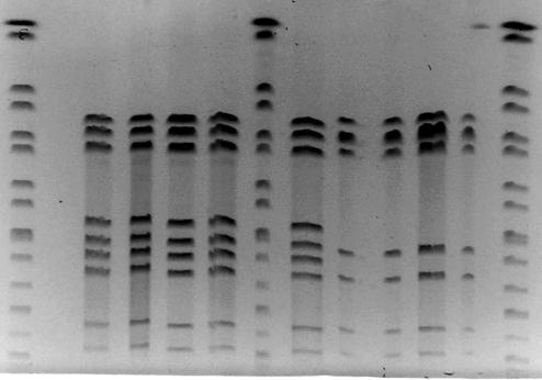 PCR/RFLP PFGE