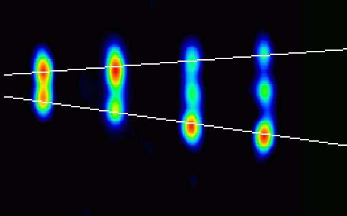 Micro-Quasar GRS1915 Radio images show one plasma bubble coming almost directly toward us at 90