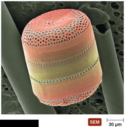 Figure 12.31 Coscinodiscus, a diatom.