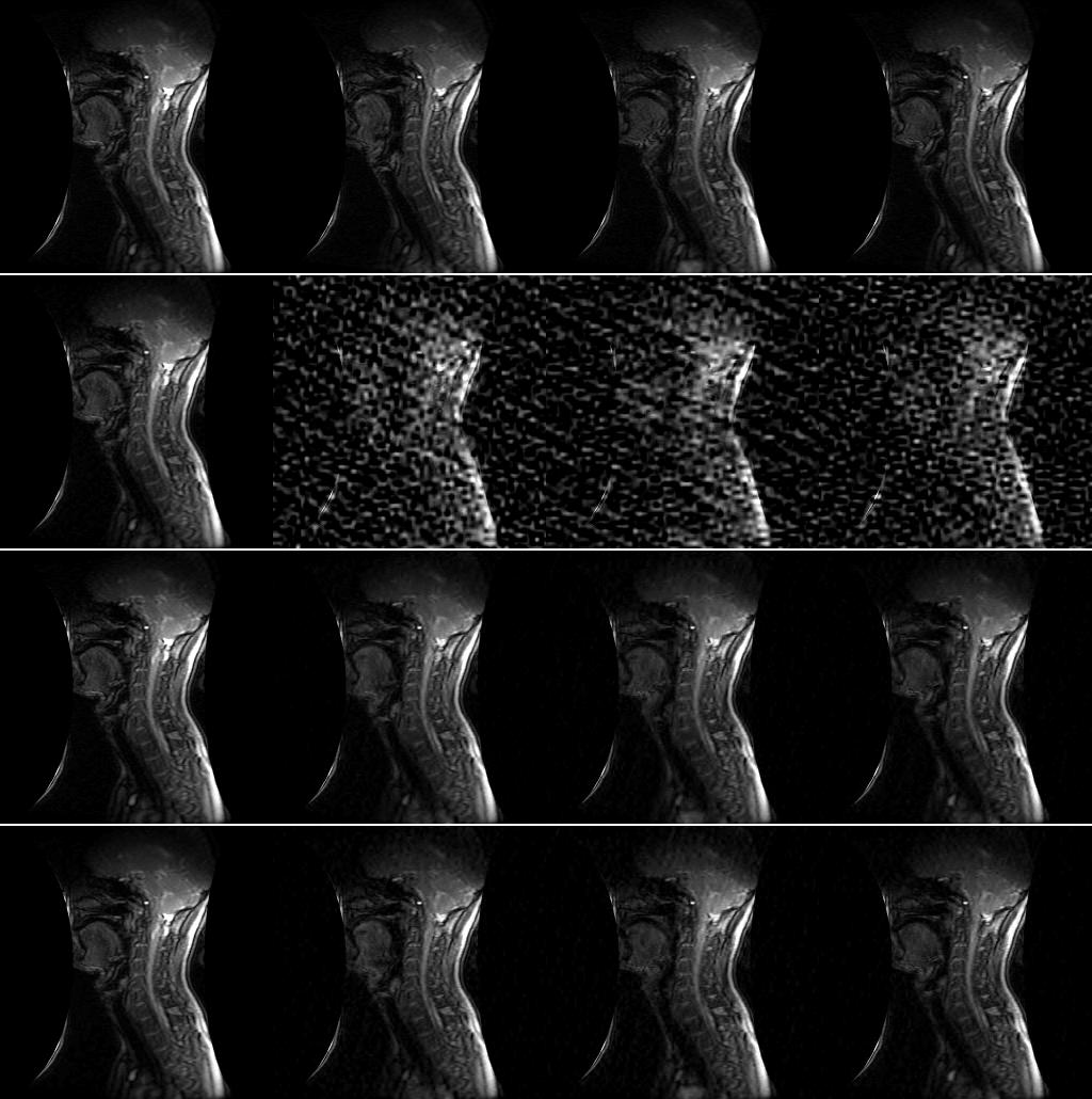 Performance on dynamic-mri dataset: Frames 1, 2, 5, and 10 of a dynamic MRI image sequence: True images Basis pursuit Modified-CS