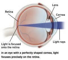 Sight Defects o Short-sightedness means we can only see close objects clearly it is due to light focusing before the retina (caused by elongation of the eyeball) o Long-sightedness means that we can