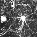 and analyzed. (A) Neurite detection with MAP- staining.