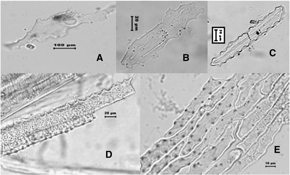 J. Mazumdar / South African Journal of Botany 77 (2011) 10 19 11 Fig. 1. Phyoliths of Huperzia selago (A), Blechnum orientale (B), Vittaria himalayaensis (C), Equisetum diffusum (D) and Selaginella bryopteris (E).