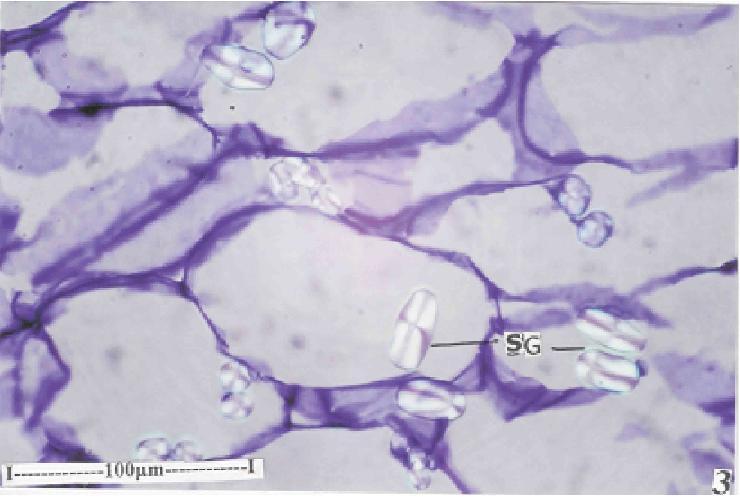 2 Vascular bundle of the leaf enlarged (Ph- Phloem; SC-