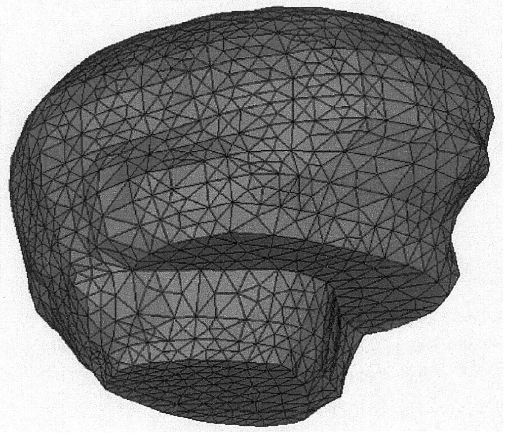 Figure 4: isometric view of the model of the brain.