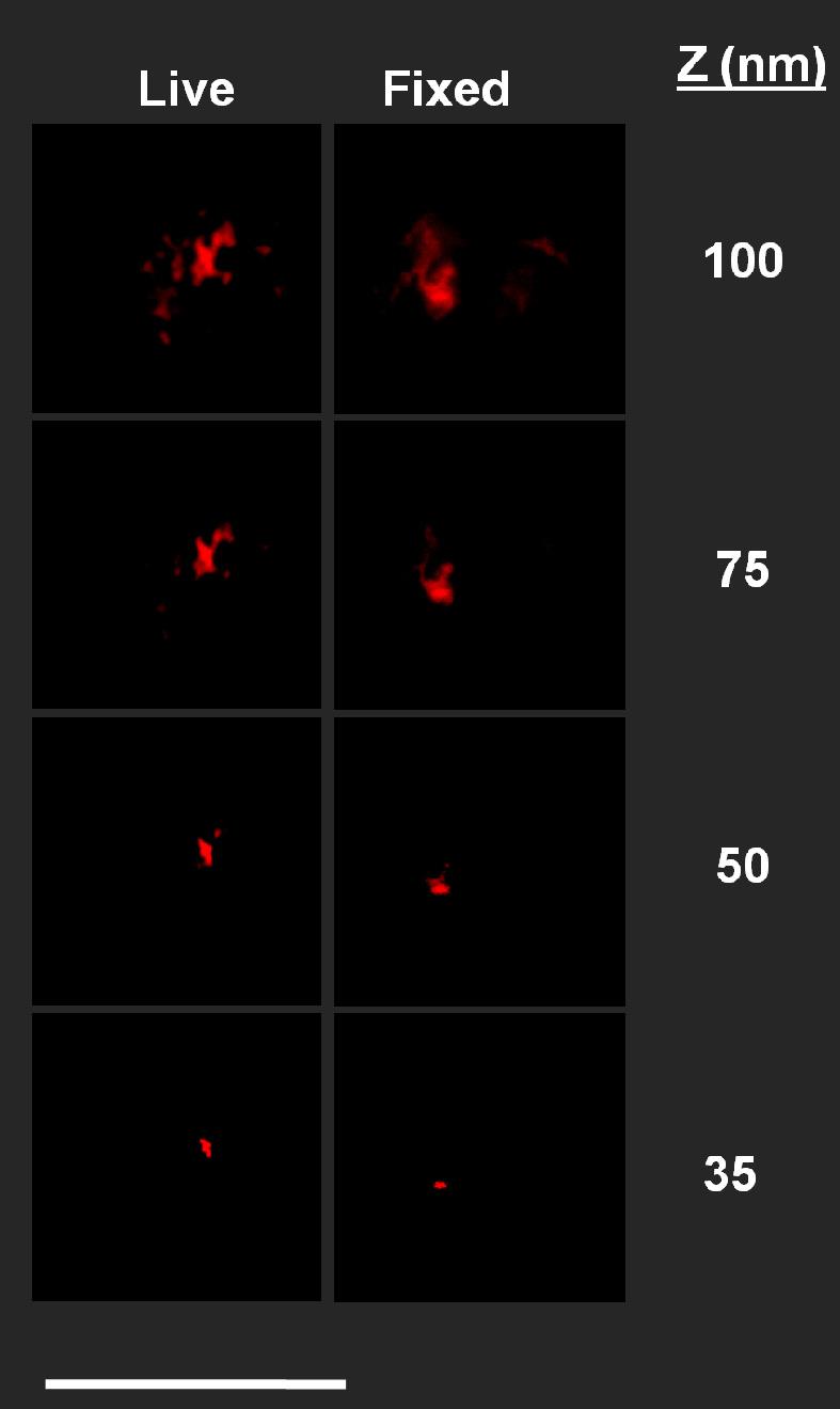 Supplementary igure 2 ootprints of live and fixed neutrophils.