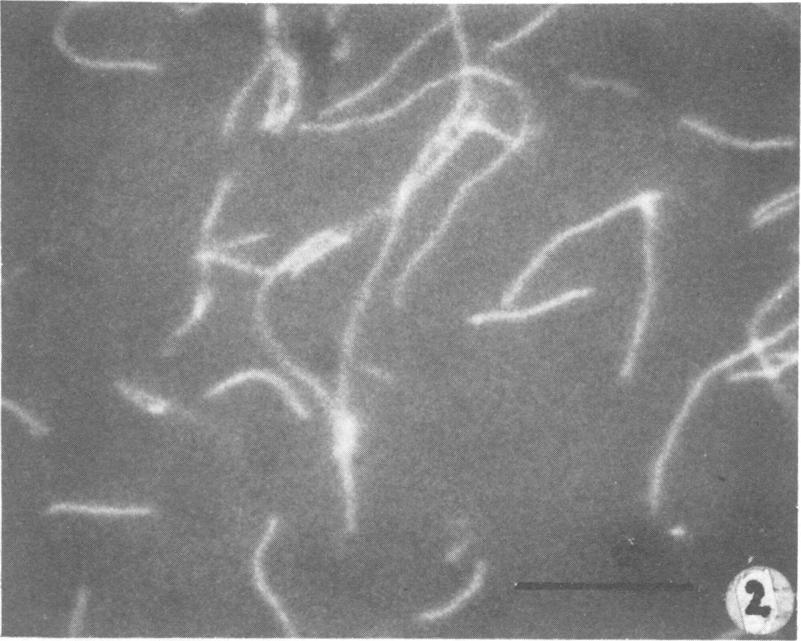 Although all species initially exhibited cellular autofluorescence of comparable intensity when observed under ultraviolet light, the autofluorescence of Methanobacterium strain M.o.H. and M.