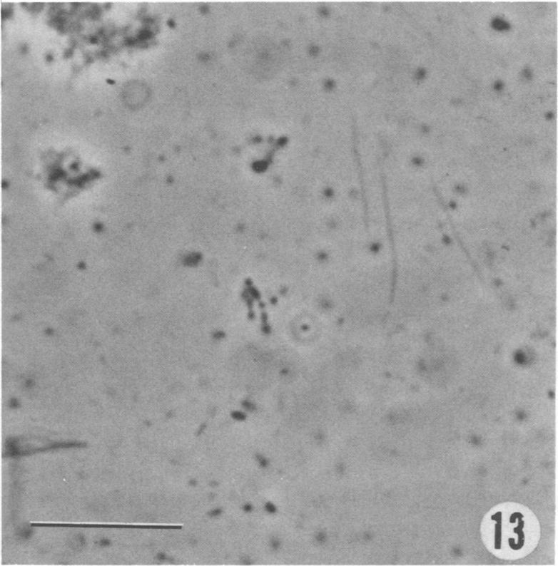 VOL. 33, 1977 IDENTIFICATION OF METHANOGENIC BACTERIA 717 FIG. 13 and 15. Rumen fluid, phase contrast. FIG. 14 and 16. Respective fields of Fig.