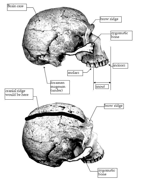 Here are the parts of the skull